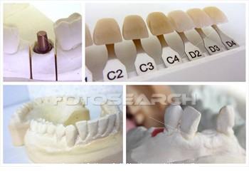 proteza dentystyczna